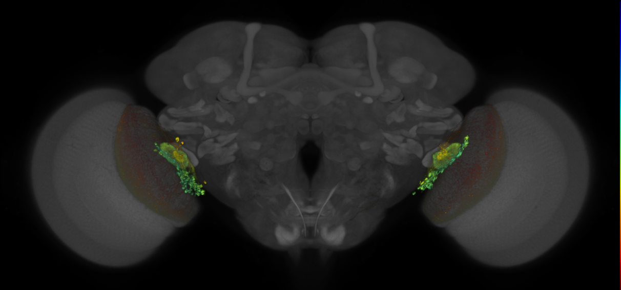 JRC_OL0005B_Brain_2016_20140611_32_F1_20x