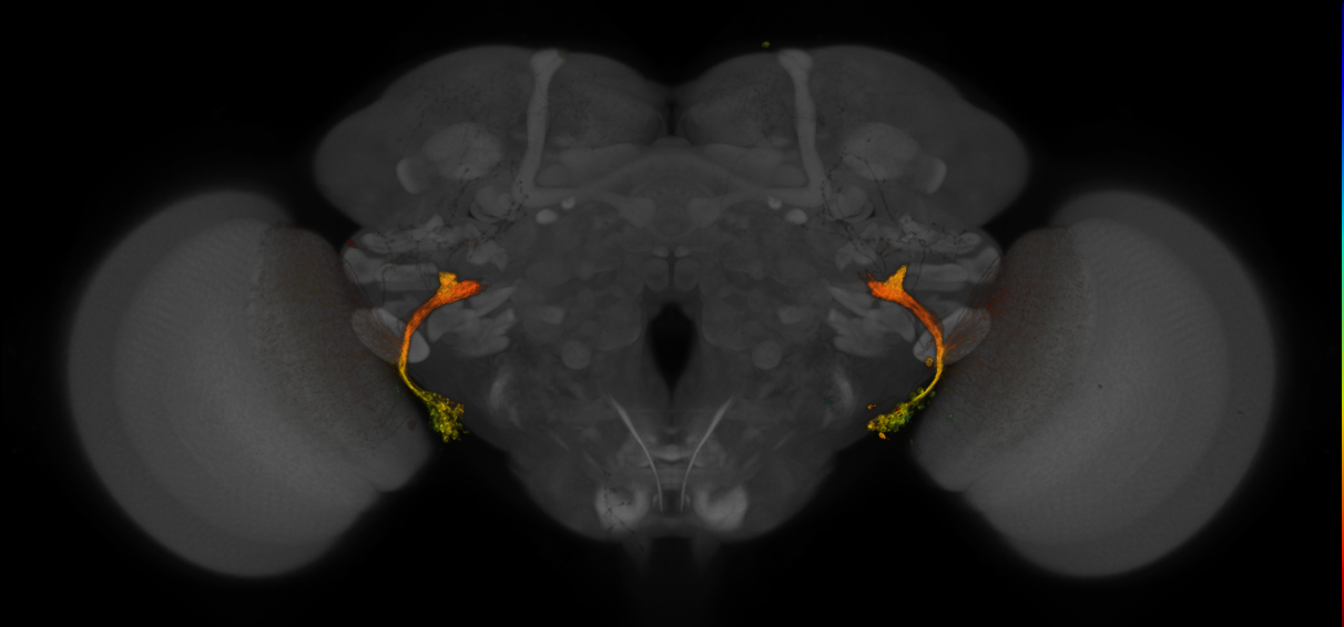 JRC_OL0027B_Brain_2016_20140611_32_H1_20x