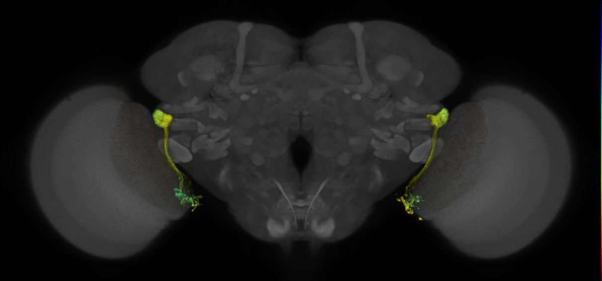 JRC_OL0003B_Brain_2016_20140612_31_A1_20x