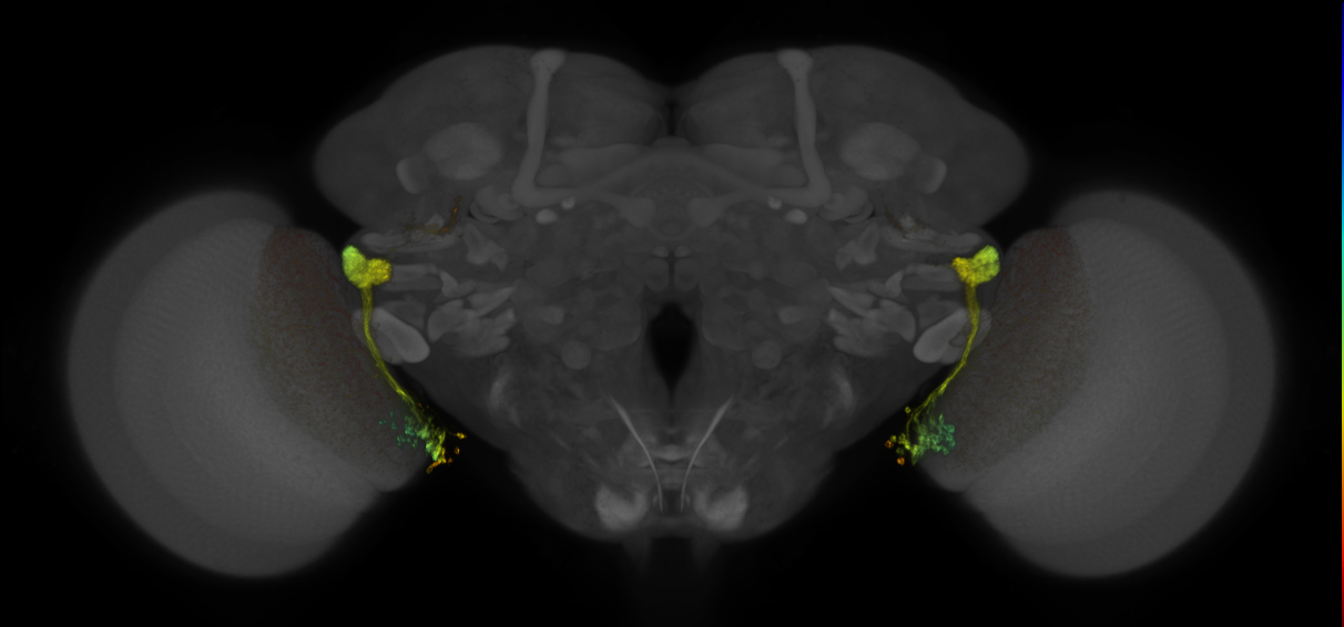 JRC_OL0004B_Brain_2016_20140612_31_C3_20x