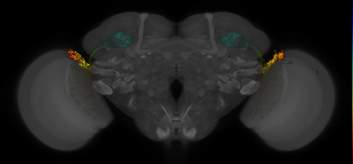 JRC_OL0019B_Brain_2016_20140611_31_A2_20x