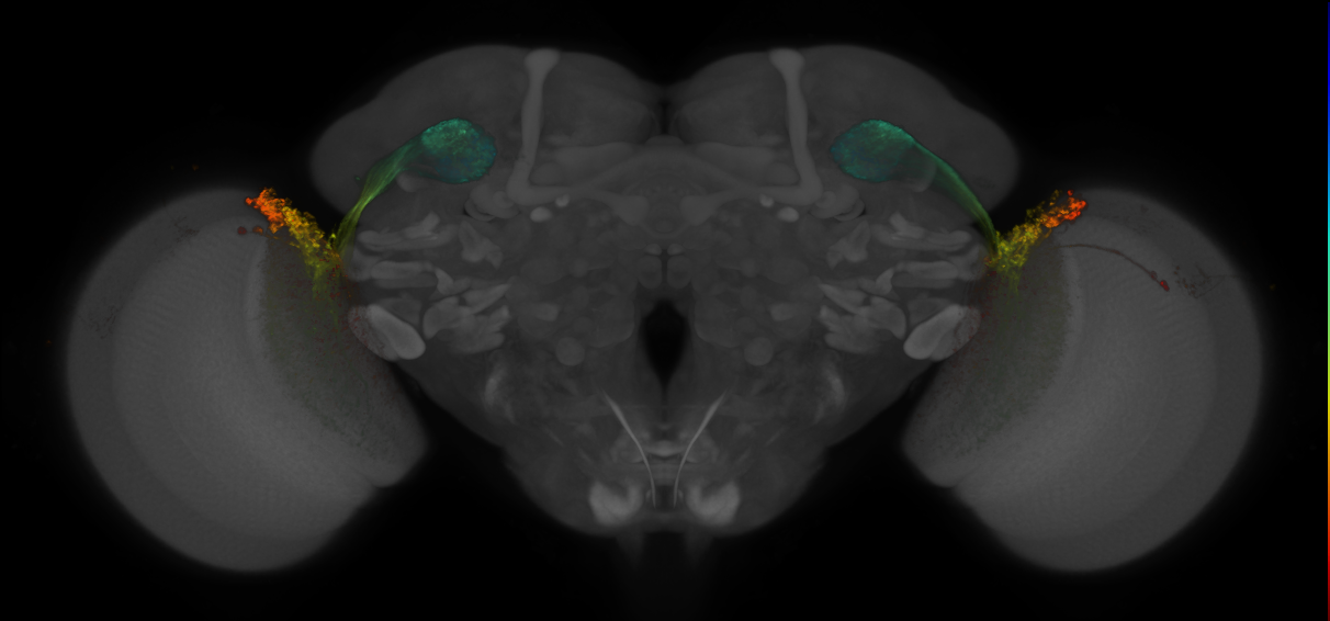 JRC_OL0020B_Brain_2016_20140611_31_D1_20x