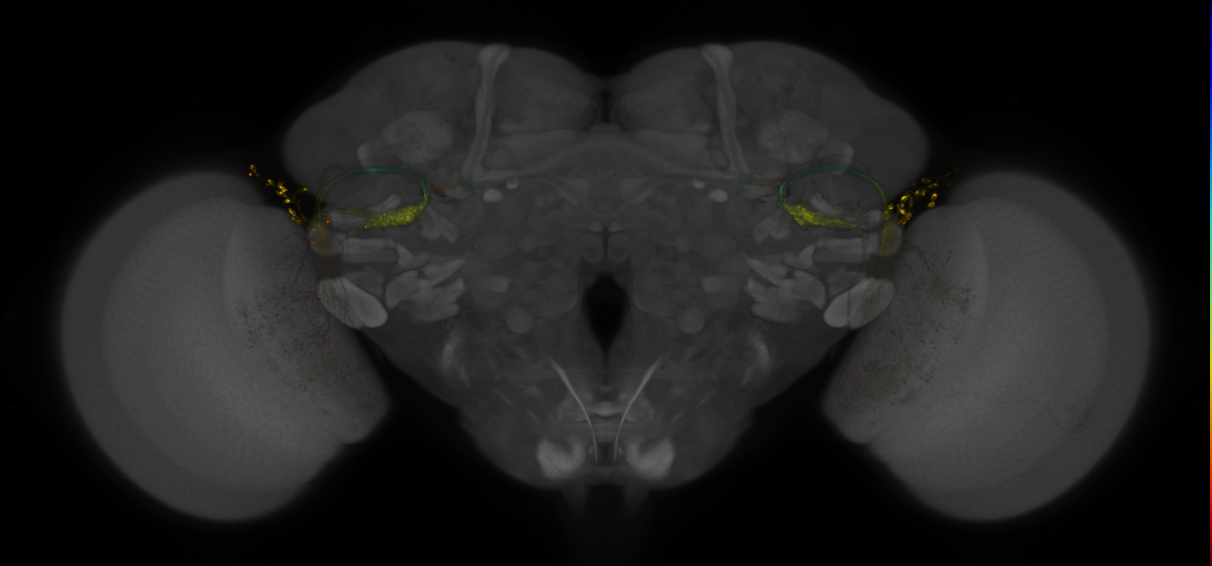 JRC_OL0081B_Brain_2016_20140613_31_E3_20x