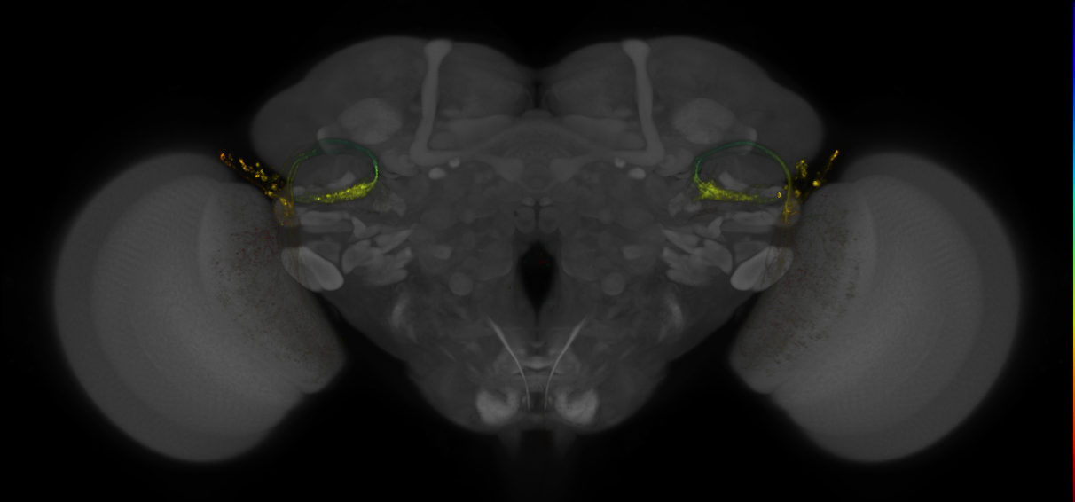 JRC_OL0087B_Brain_2016_20140613_31_F2_20x
