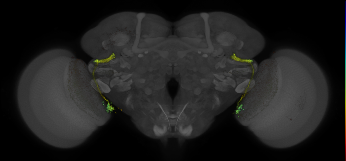JRC_OL0092C_Brain_2016_20140612_31_G2_20x
