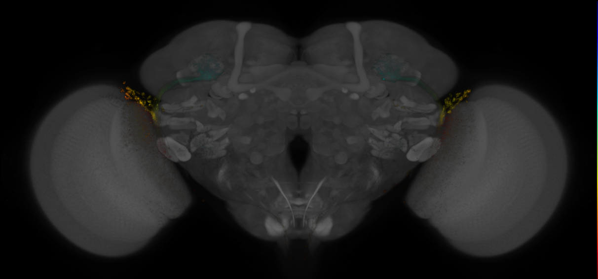 JRC_OL0023B_Brain_2016_20140611_31_G2_20x