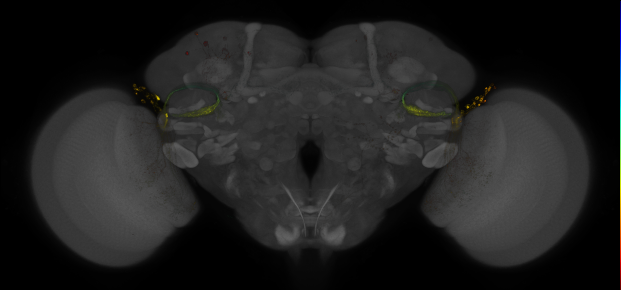 JRC_OL0071B_Brain_2016_20140613_31_I1_20x