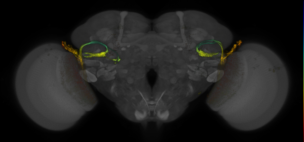 JRC_OL0202B_Brain_2016_20140620_31_I2_20x