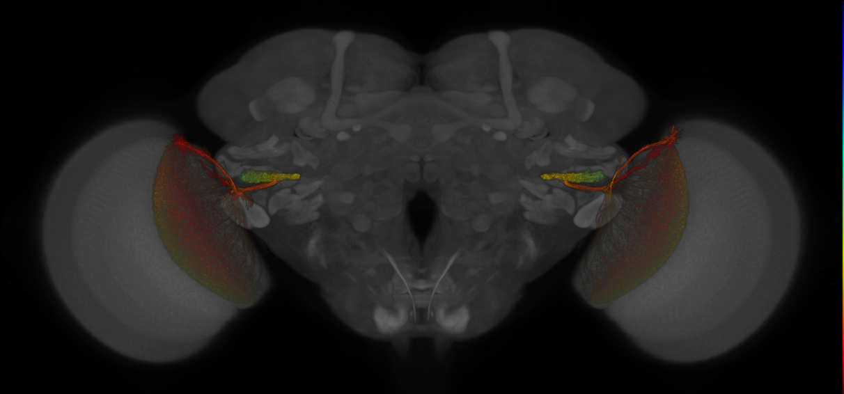 JRC_OL0015B_Brain_2016_20130702_31_H1_63x