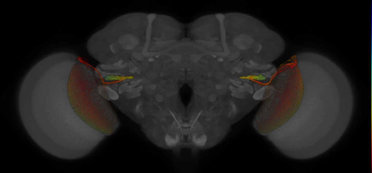 JRC_OL0015B_Brain_2016_20130702_31_H3_63x
