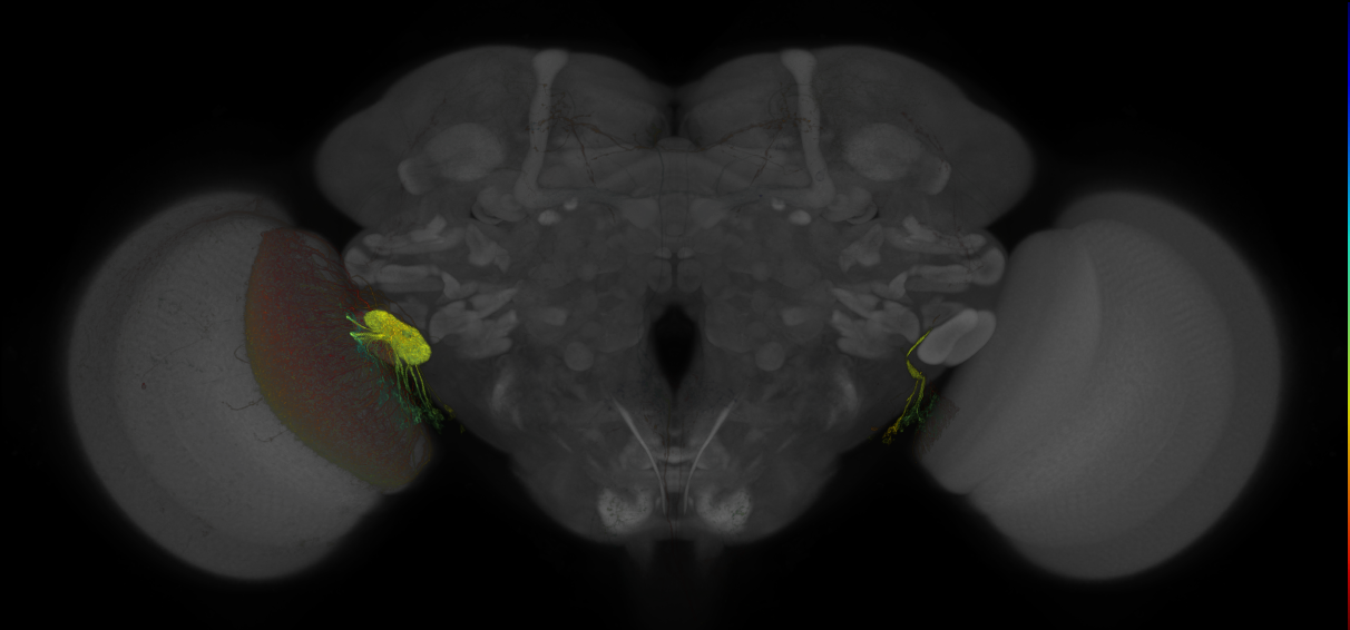 JRC_OL0008B_Brain_2016_20131227_31_G3_63x