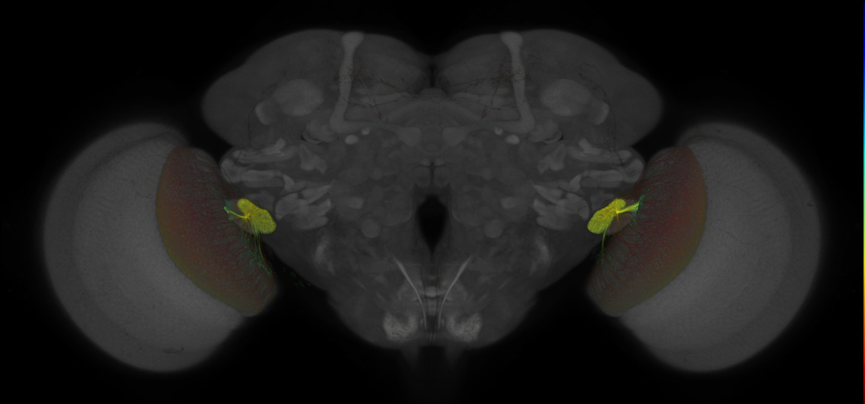 JRC_OL0008B_Brain_2016_20140425_32_G2_63x