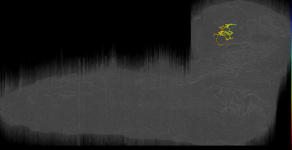 BLAd ant med 3 neuron left (L1EM:3946569)