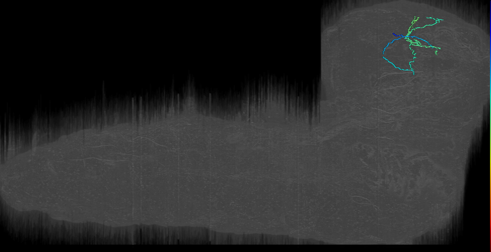 ITP candidate pair 2 right; candidate 3 right (L1EM:7529574)