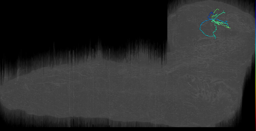 ITP candidate 4 right (L1EM:7530253)