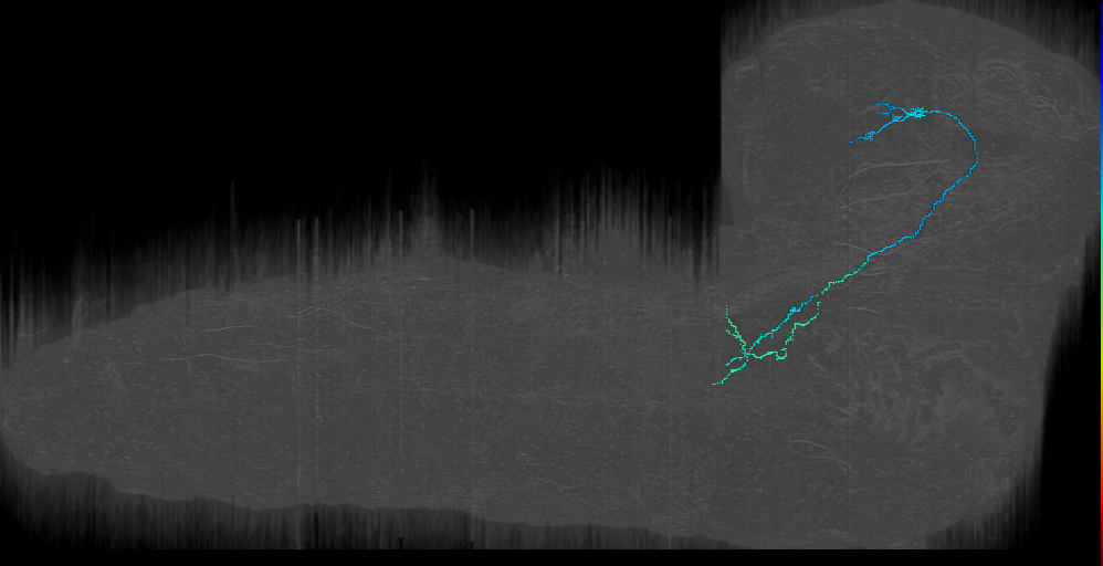 ASB Ascending right 10842369 (L1EM:10842368)