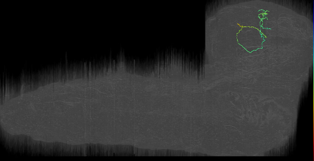 ITP candidate 4 left (L1EM:16683943)