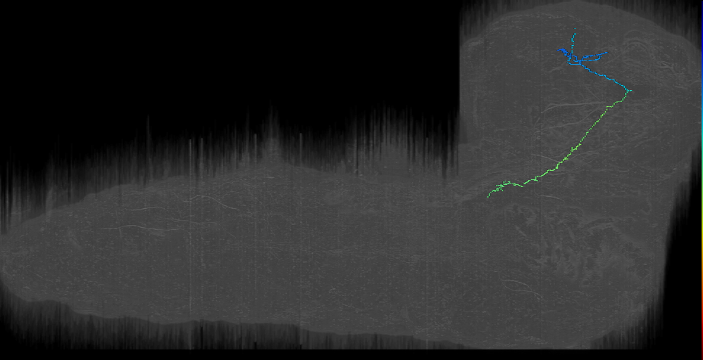 DPMpl12 Brain into SEZ? right (L1EM:17352470)