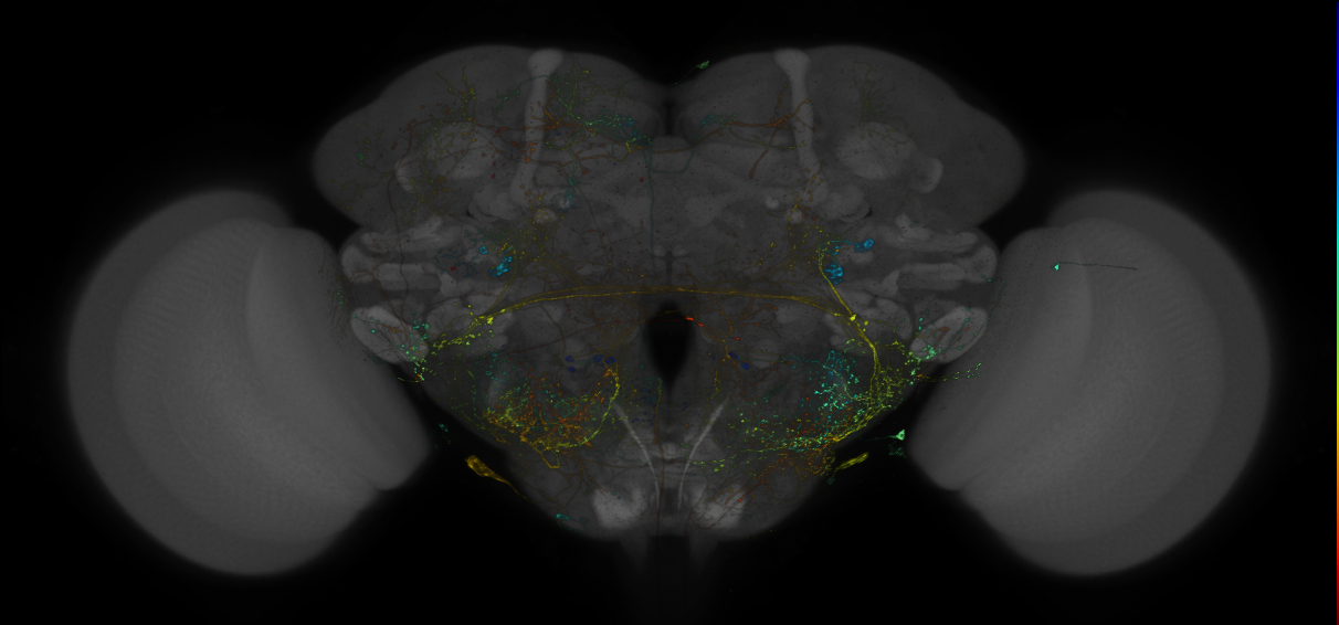 VDRC_VT025981-GAL4_MCFO_Brain_20170525_61_E2_40x