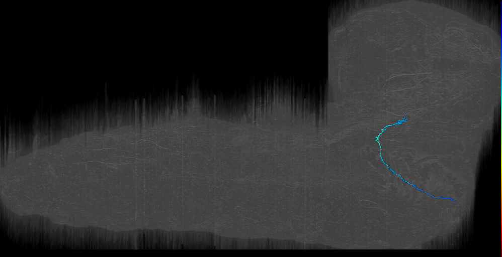 MN-R-Sens-B2-ACp-14 (L1EM:12253020)