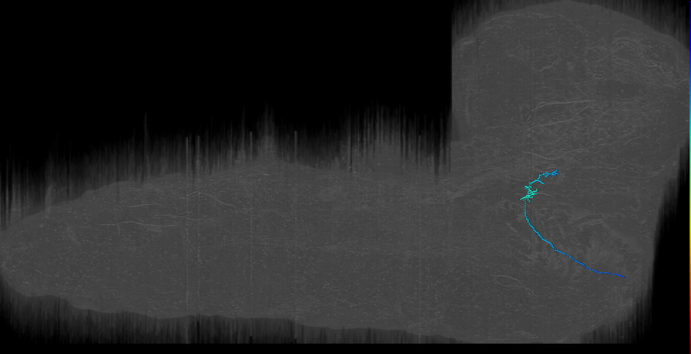 MN-R-Sens-B2-ACp-20 (L1EM:15588800)