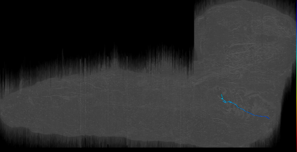 MN-R-Sens-B2-VM-11 (L1EM:15615305)