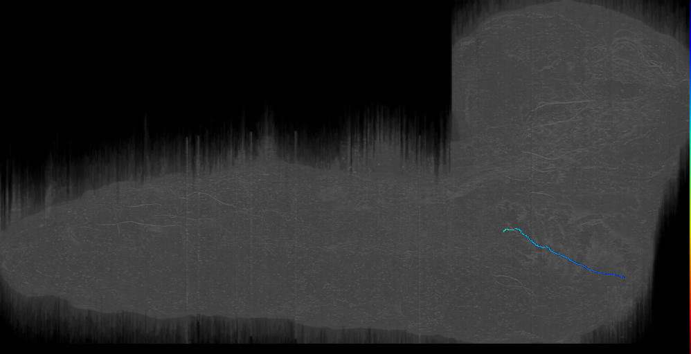 MN-R-Sens-B2-VM-18 (L1EM:15629888)