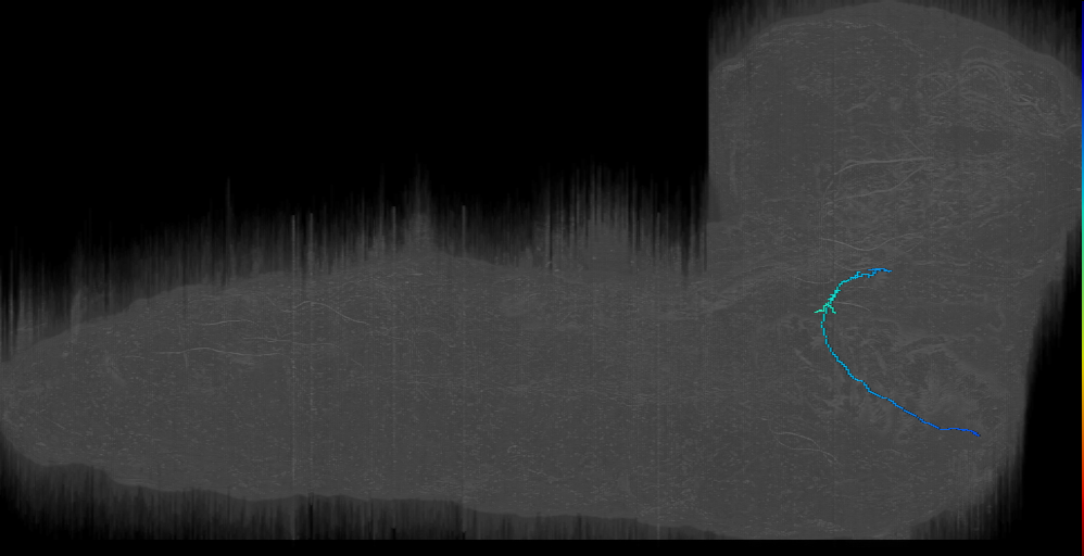 MN-R-Sens-B2-ACp-22 (L1EM:15651438)
