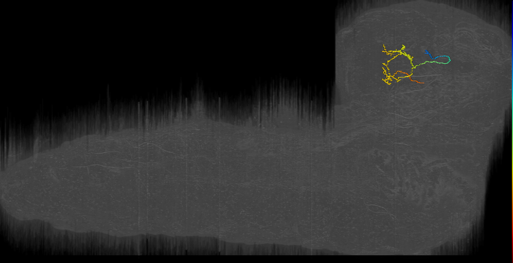 DPlal bilateral 1 left (L1EM:15686444)