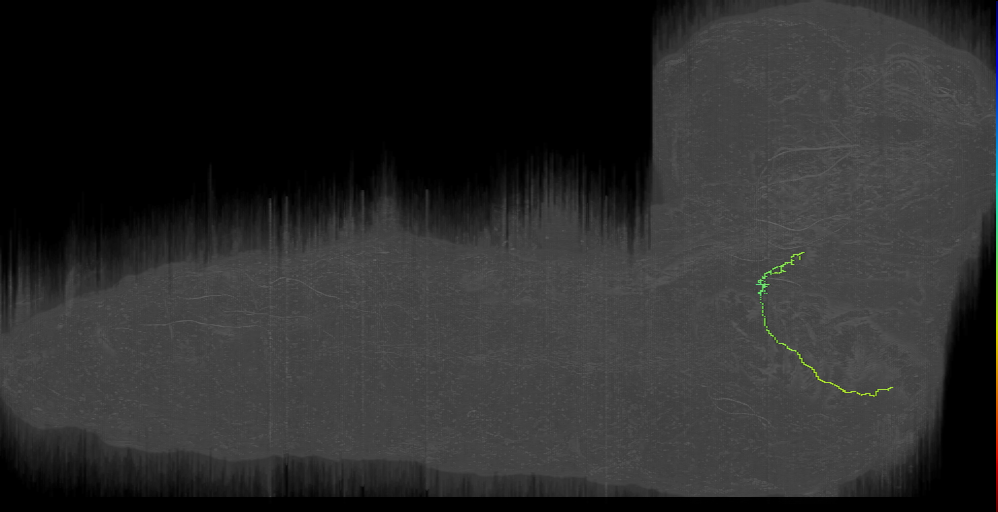 MN-L-Sens-B2-ACp-20 (L1EM:15688358)