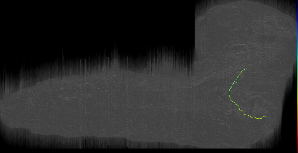 MN-L-Sens-B2-ACp-03 (L1EM:15716309)