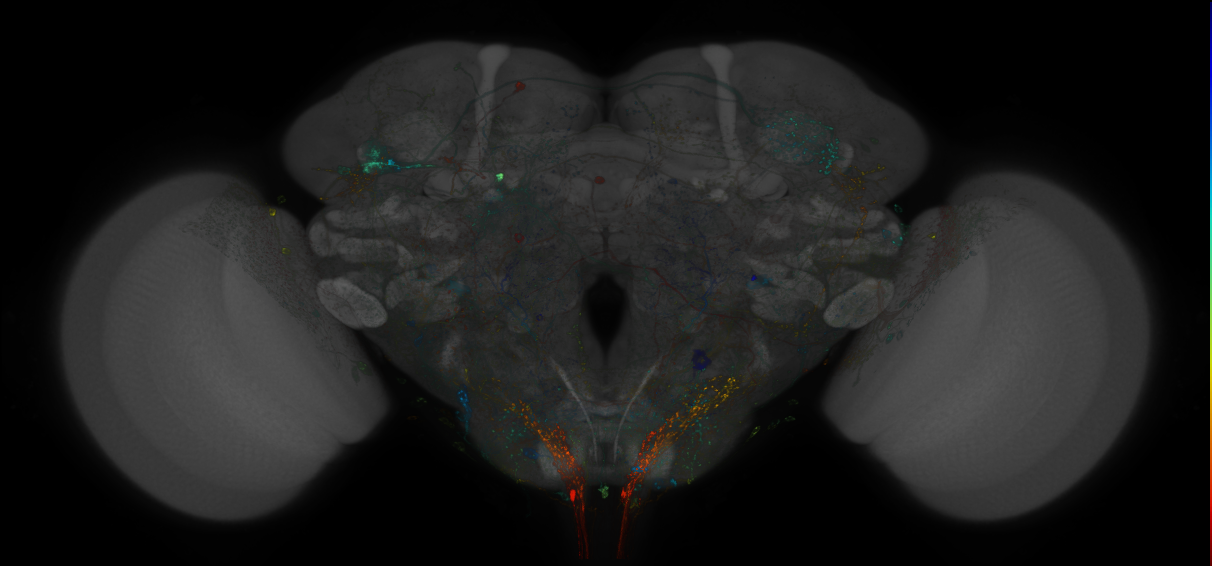 VDRC_VT026341-GAL4_MCFO_Brain_20180413_65_A3_40x
