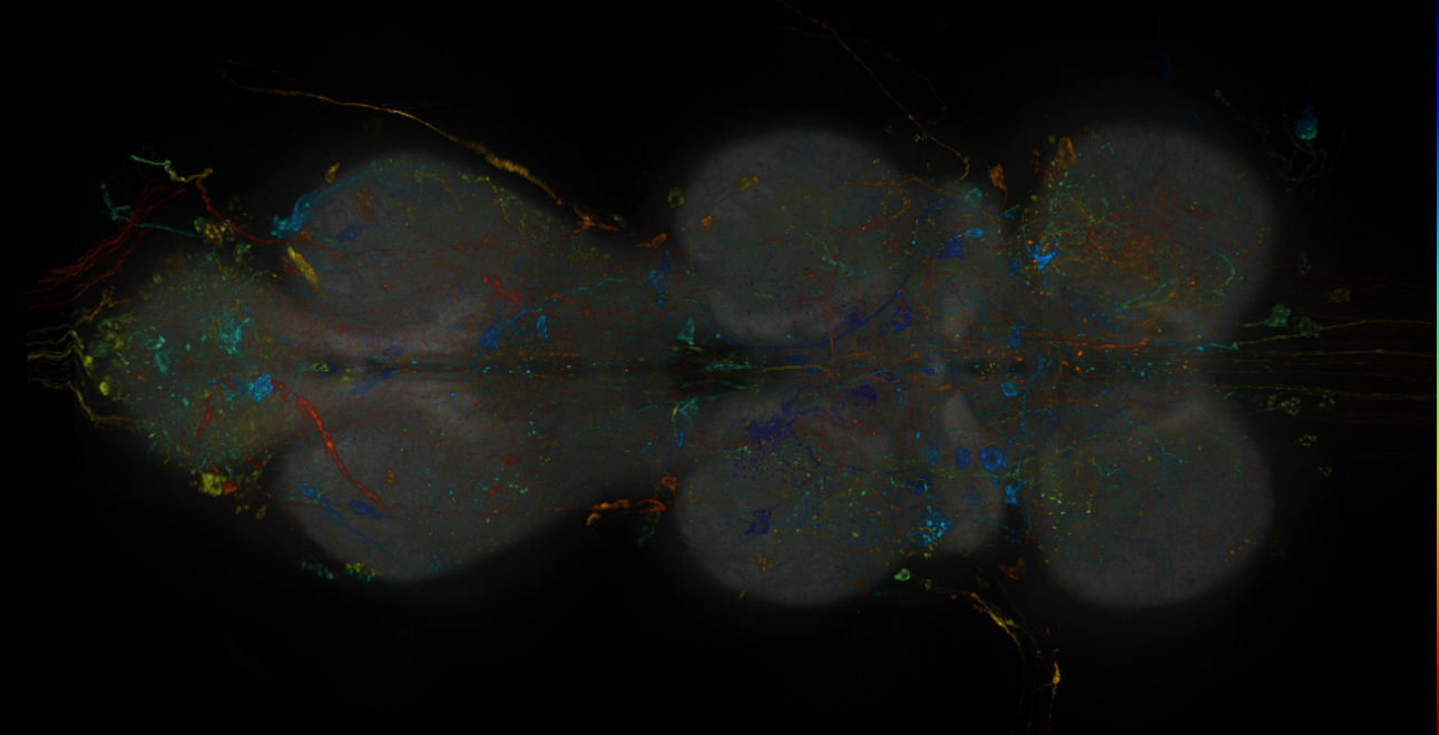 JRC_R10C02-GAL4_MCFO_VNC_20181109_62_B5_40x