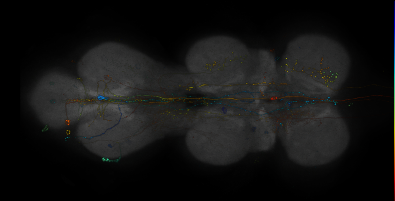 JRC_R16H11-GAL4_MCFO_VNC_20181109_63_B1_40x