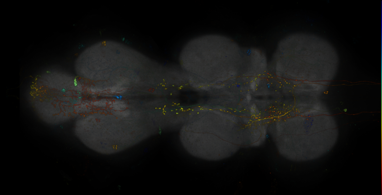 JRC_R16H11-GAL4_MCFO_VNC_20181109_63_B6_40x