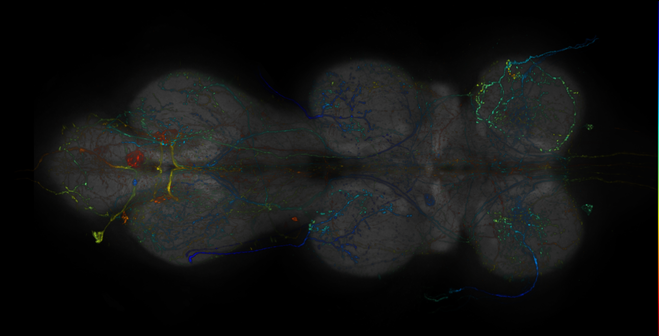 JRC_R10E08-GAL4_MCFO_VNC_20181109_64_E5_40x