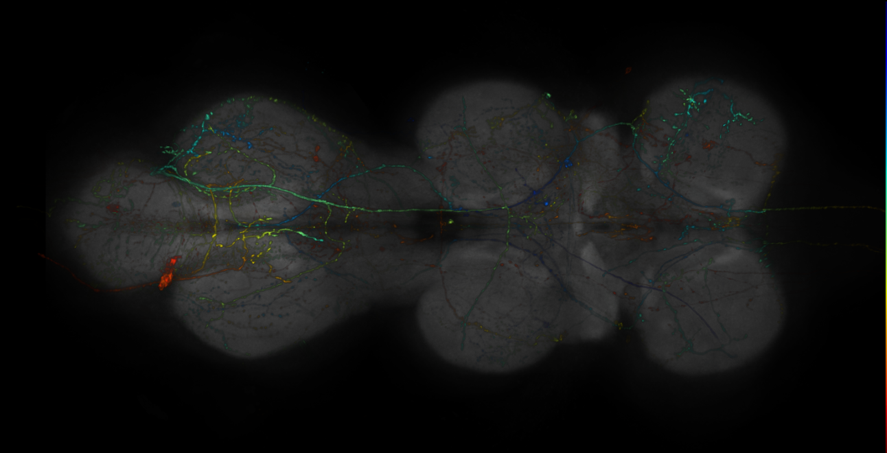 JRC_R10E08-GAL4_MCFO_VNC_20181109_64_E6_40x