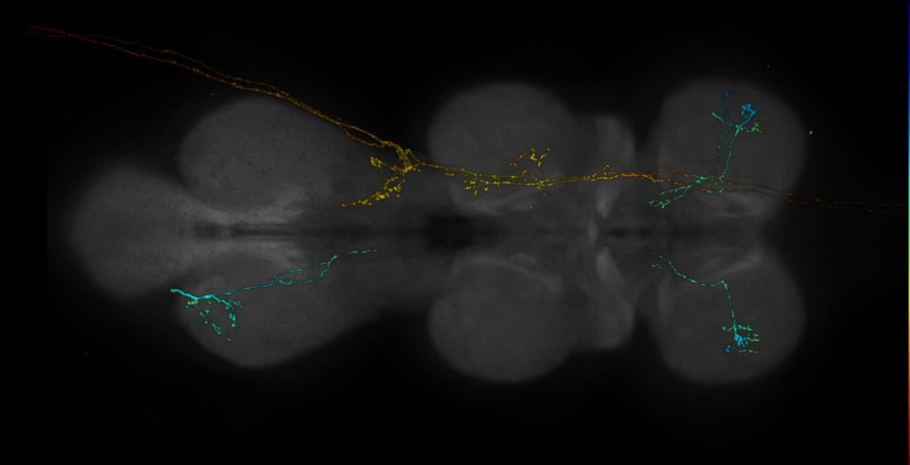 JRC_R10H03-GAL4_MCFO_VNC_20181113_61_E6_40x