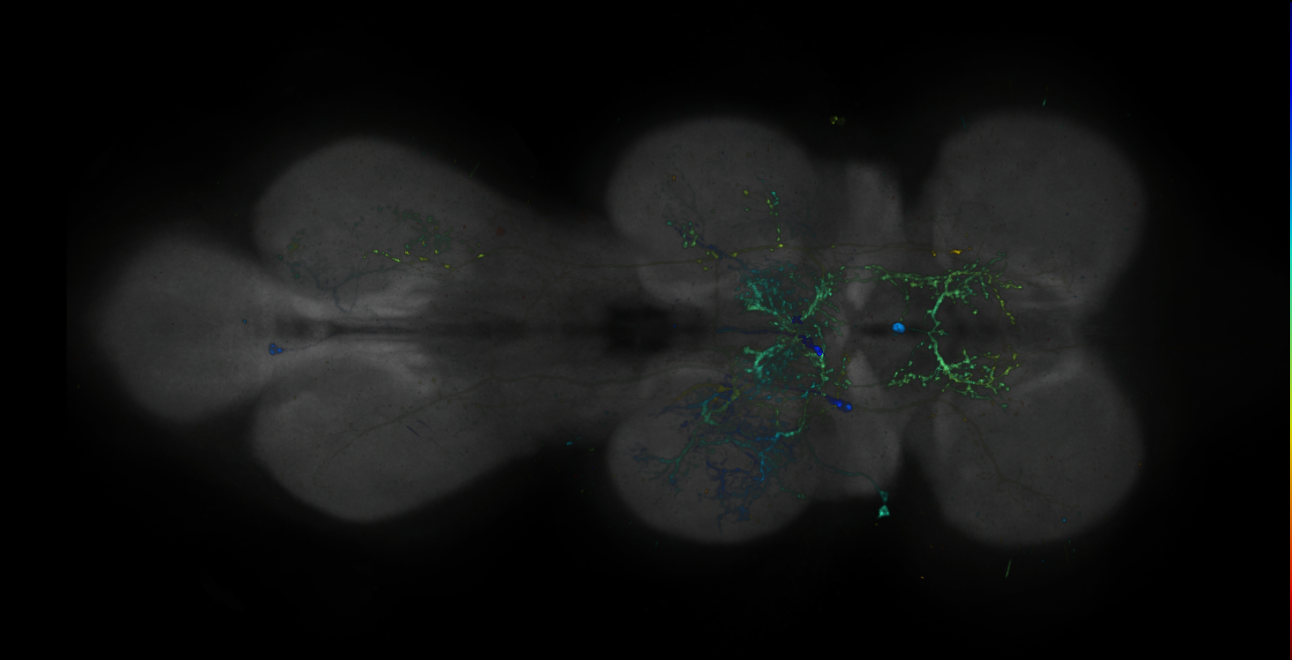 JRC_R15F04-GAL4_MCFO_VNC_20181113_62_A4_40x