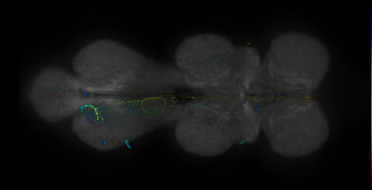 JRC_R10B02-GAL4_MCFO_VNC_20181116_63_H6_40x