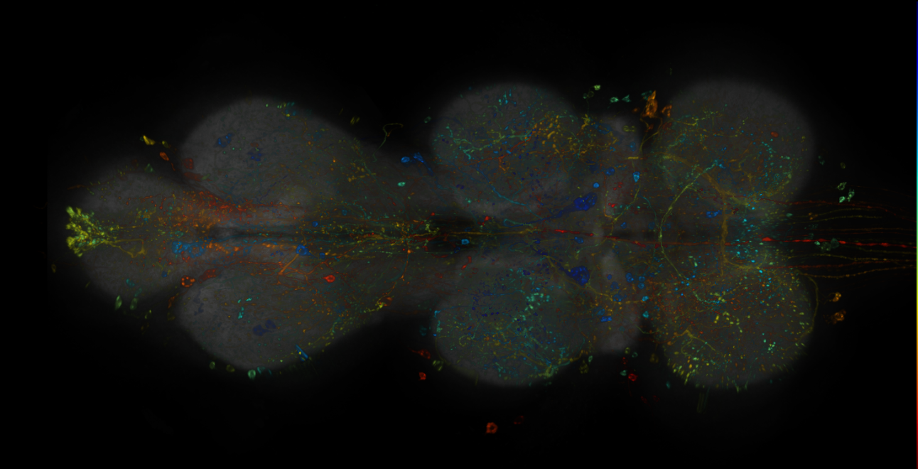 JRC_R11B12-GAL4_MCFO_VNC_20181121_61_F5_40x