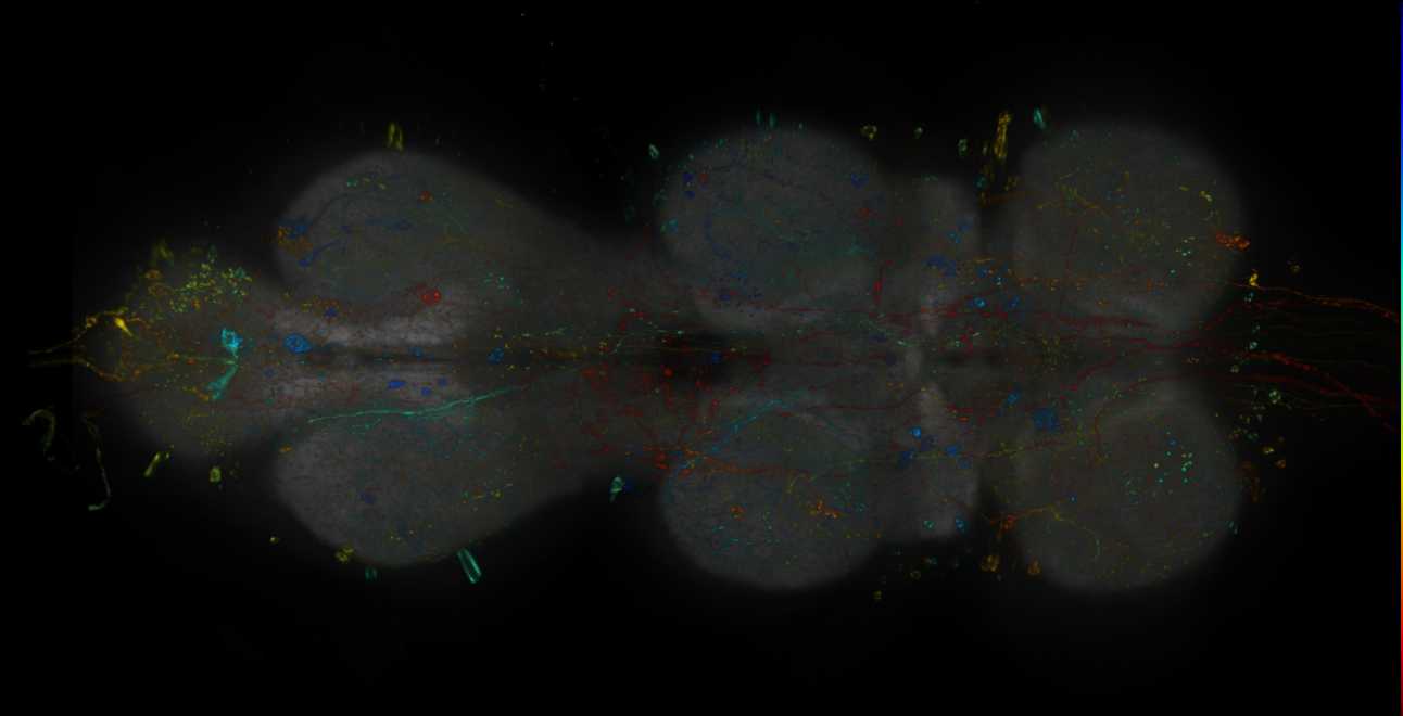 JRC_R11B12-GAL4_MCFO_VNC_20181121_61_F6_40x