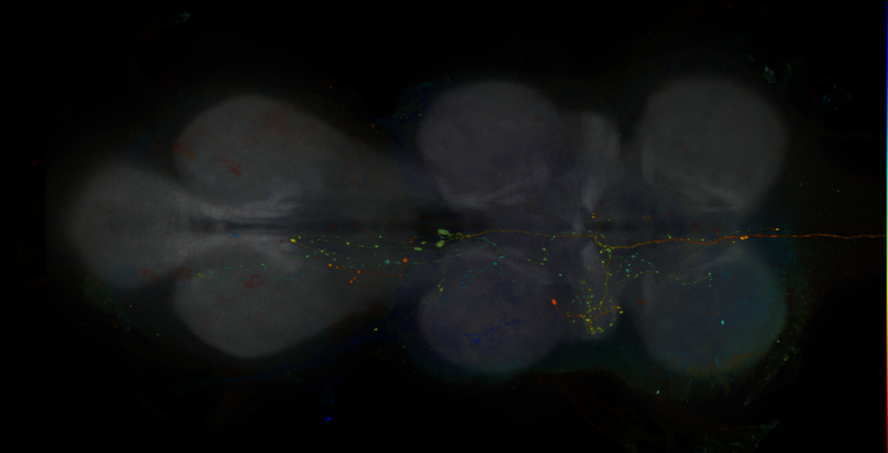 JRC_R10F10-GAL4_MCFO_VNC_20181121_61_J3_40x