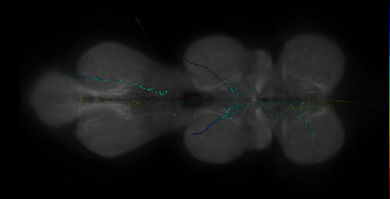 JRC_R11H10-GAL4_MCFO_VNC_20181121_62_I6_40x