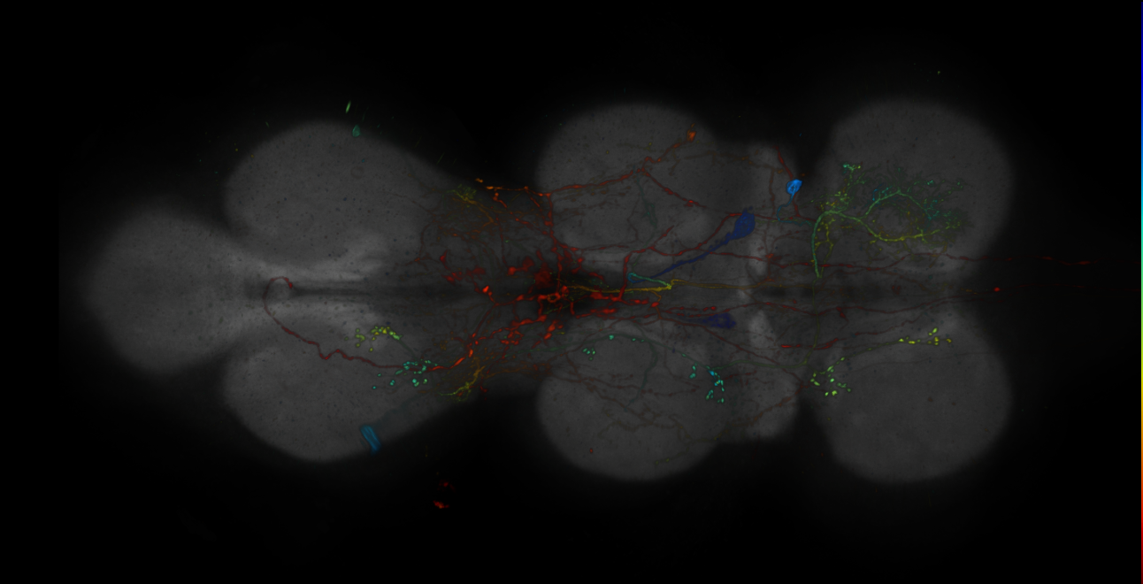 JRC_R10C06-GAL4_MCFO_VNC_20181121_63_G2_40x