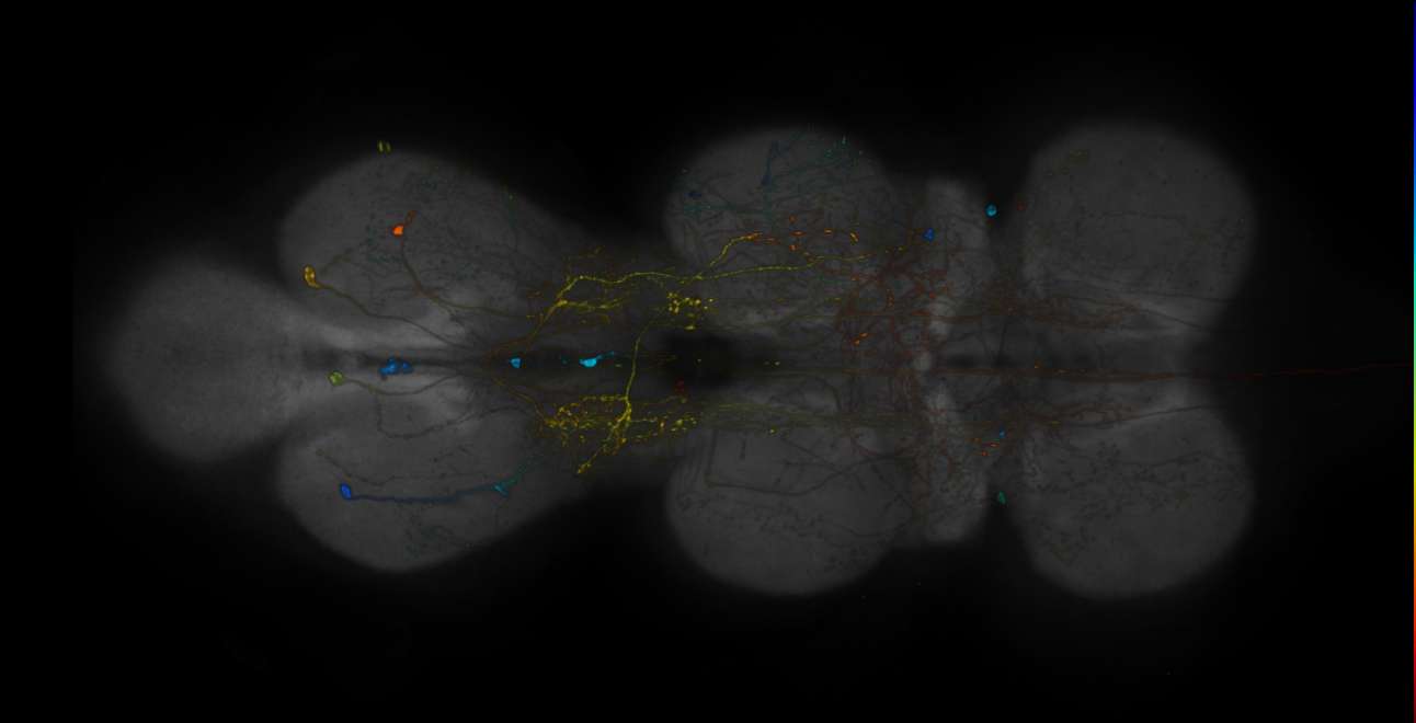 JRC_R10G01-GAL4_MCFO_VNC_20181121_63_J4_40x