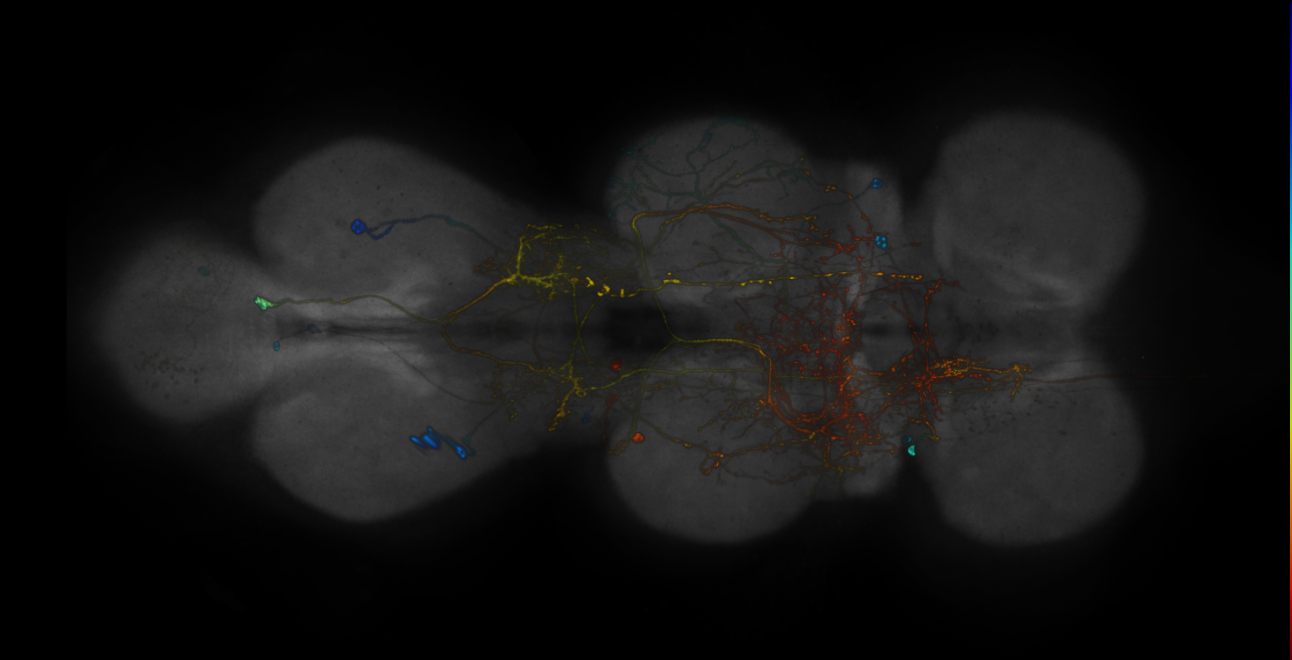 JRC_R10G01-GAL4_MCFO_VNC_20181121_63_J5_40x