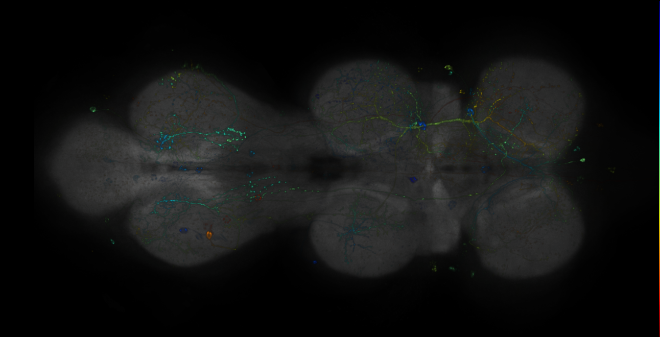 JRC_R13C04-GAL4_MCFO_VNC_20181121_65_E5_40x