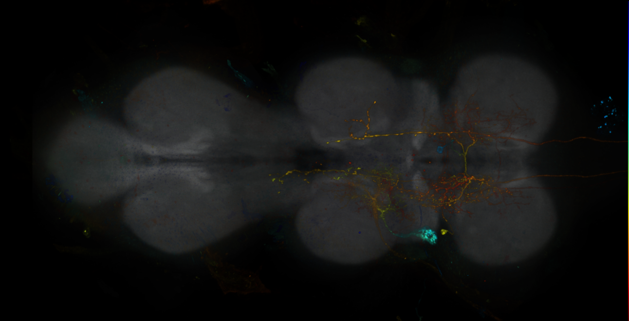 JRC_R14B02-GAL4_MCFO_VNC_20181121_66_H1_40x