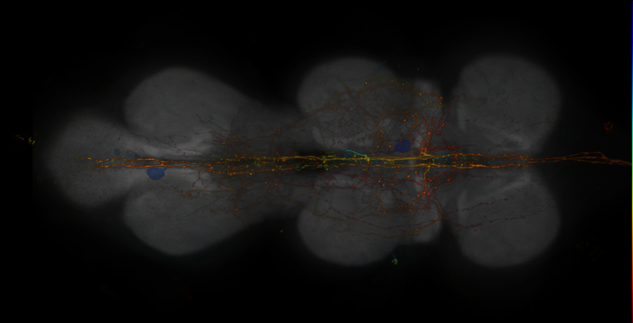 JRC_R15F08-GAL4_MCFO_VNC_20181127_62_H3_40x
